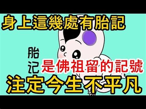 小細節大影響 胎記是什麼